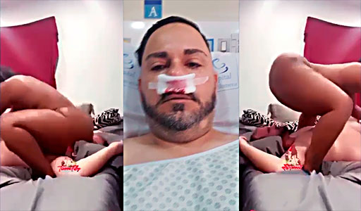 maniacal slut breaks his nose with her smashing ass